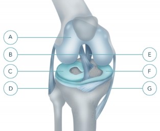 artritis koljena jaka bol